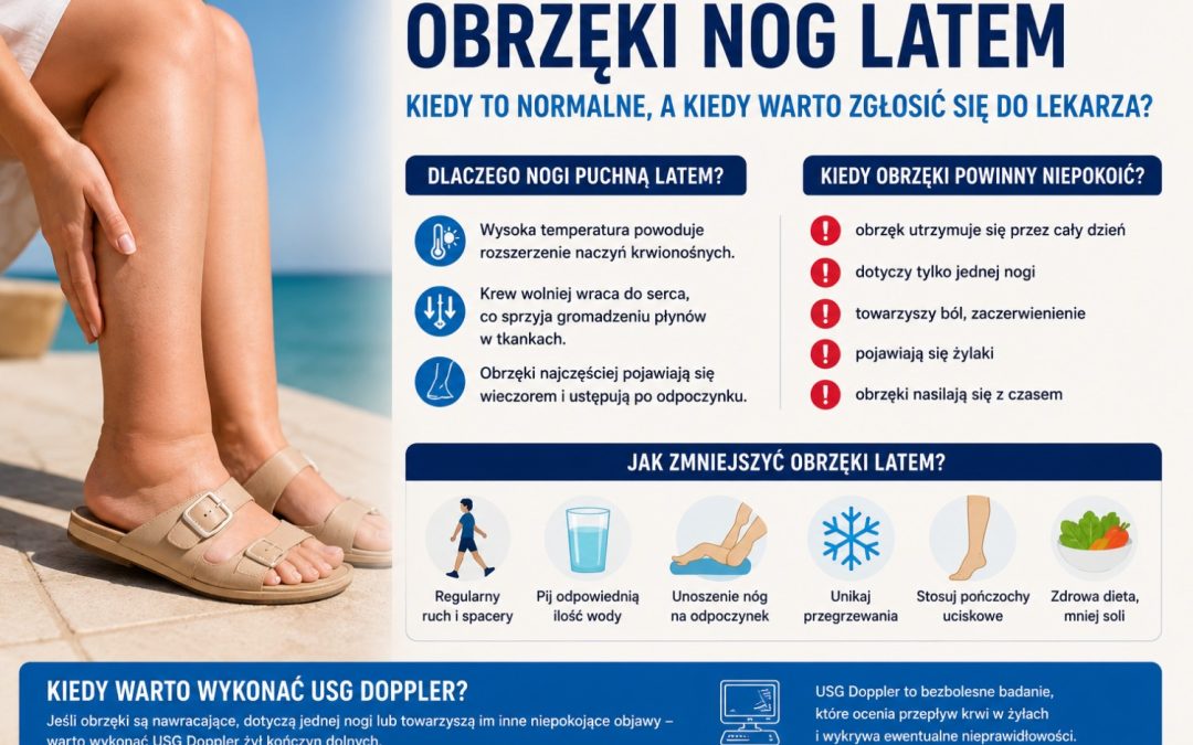 Obrzęki nóg latem